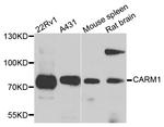 PRMT4 Antibody in Western Blot (WB)