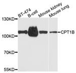 CPT1B Antibody in Western Blot (WB)