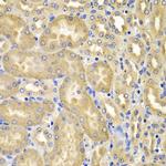 XIAP Antibody in Immunohistochemistry (Paraffin) (IHC (P))