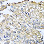 MCP-2 Antibody in Immunohistochemistry (Paraffin) (IHC (P))