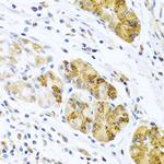 MCP-2 Antibody in Immunohistochemistry (Paraffin) (IHC (P))