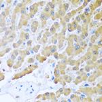 MCP-2 Antibody in Immunohistochemistry (Paraffin) (IHC (P))