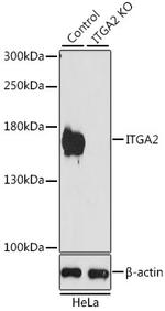 CD49b (Integrin alpha 2) Antibody in Western Blot (WB)
