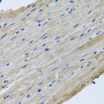 YBX1 Antibody in Immunohistochemistry (Paraffin) (IHC (P))