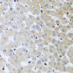 YBX1 Antibody in Immunohistochemistry (Paraffin) (IHC (P))