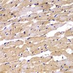 PSEN2 Antibody in Immunohistochemistry (Paraffin) (IHC (P))