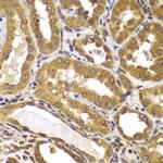 PSEN2 Antibody in Immunohistochemistry (Paraffin) (IHC (P))