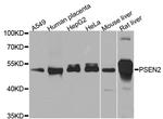 PSEN2 Antibody in Western Blot (WB)