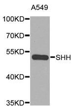 SHH Antibody in Western Blot (WB)