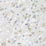 HARS2 Antibody in Immunohistochemistry (Paraffin) (IHC (P))