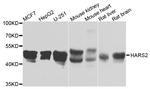 HARS2 Antibody in Western Blot (WB)