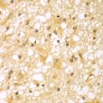 PAK6 Antibody in Immunohistochemistry (Paraffin) (IHC (P))