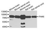 PAK6 Antibody in Western Blot (WB)