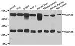 CD16 Antibody in Western Blot (WB)