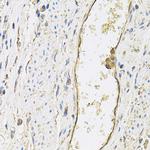 P-Selectin Antibody in Immunohistochemistry (Paraffin) (IHC (P))