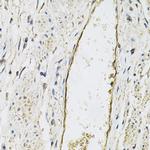 P-Selectin Antibody in Immunohistochemistry (Paraffin) (IHC (P))