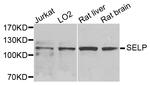 P-Selectin Antibody in Western Blot (WB)