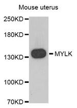 MYLK Antibody in Western Blot (WB)