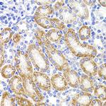 HMGCL Antibody in Immunohistochemistry (Paraffin) (IHC (P))