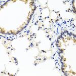 IL-29 Antibody in Immunohistochemistry (Paraffin) (IHC (P))