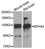 EphA4 Antibody in Western Blot (WB)