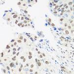 UAP56 Antibody in Immunohistochemistry (Paraffin) (IHC (P))