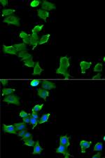 Glutamine Synthetase Antibody in Immunocytochemistry (ICC/IF)