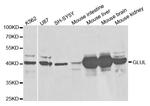 Glutamine Synthetase Antibody in Western Blot (WB)