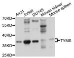 Thymidylate Synthase Antibody in Western Blot (WB)