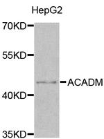 ACADM Antibody in Western Blot (WB)