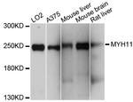 MYH11 Antibody in Western Blot (WB)