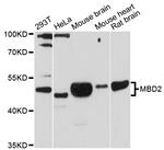 MBD2 Antibody in Western Blot (WB)