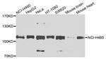 EphB2 Antibody in Western Blot (WB)