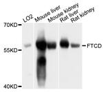 Golgi protein 58k Antibody in Western Blot (WB)