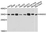 Annexin A3 Antibody in Western Blot (WB)