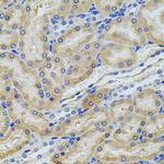 PCSK9 Antibody in Immunohistochemistry (Paraffin) (IHC (P))