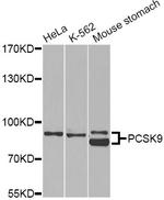 PCSK9 Antibody in Western Blot (WB)