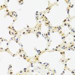 SUZ12 Antibody in Immunohistochemistry (Paraffin) (IHC (P))