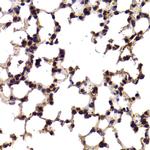 SF1 Antibody in Immunohistochemistry (Paraffin) (IHC (P))