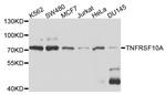 DR4 Antibody in Western Blot (WB)