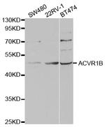 ACVR1B Antibody in Western Blot (WB)