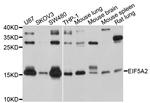 eIF5A2 Antibody in Western Blot (WB)