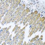 NDUFB10 Antibody in Immunohistochemistry (Paraffin) (IHC (P))