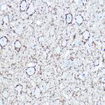 GAD67 Antibody in Immunohistochemistry (Paraffin) (IHC (P))