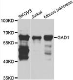 GAD67 Antibody in Western Blot (WB)