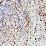 HLA-B Antibody in Immunohistochemistry (Paraffin) (IHC (P))