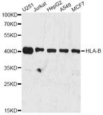 HLA-B Antibody in Western Blot (WB)