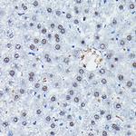 C/EBP beta Antibody in Immunohistochemistry (Paraffin) (IHC (P))