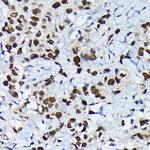 C/EBP beta Antibody in Immunohistochemistry (Paraffin) (IHC (P))