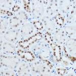 hnRNP H1 Antibody in Immunohistochemistry (Paraffin) (IHC (P))